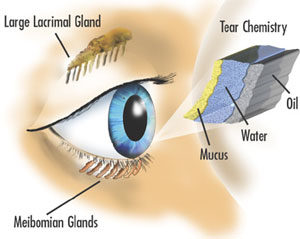 dry-eye-diagram